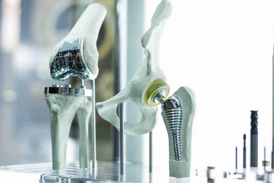 Orthopedic-3d-printing-image